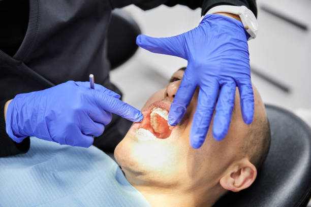 Best Urgent Care for Lost Fillings or Crowns in Los Alamos, CA