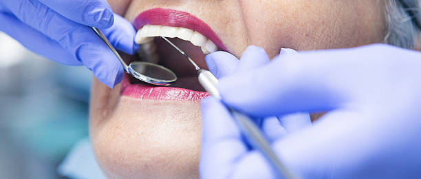 Best Emergency Gum Treatment in Los Alamos, CA