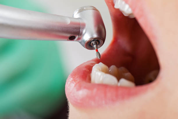 Best Emergency TMJ Treatment in Los Alamos, CA